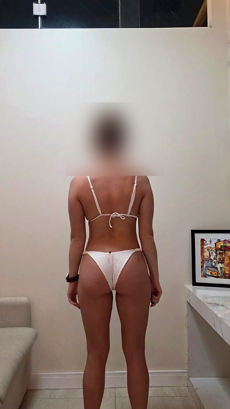 Evolução 4, ângulo posterior, depois do acompanhamento